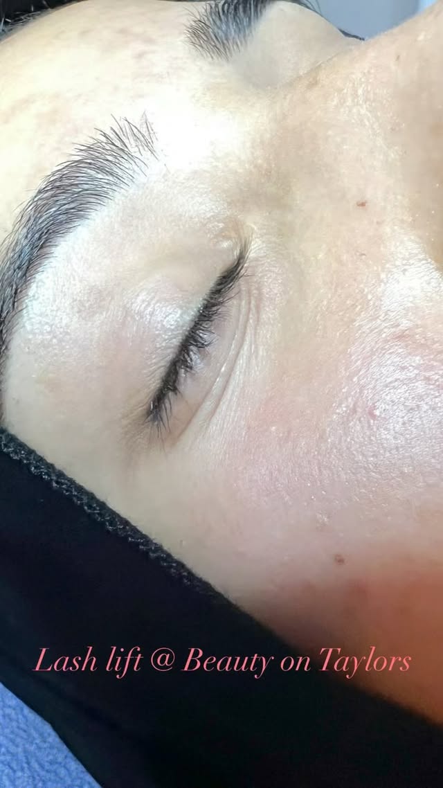 Brow detail