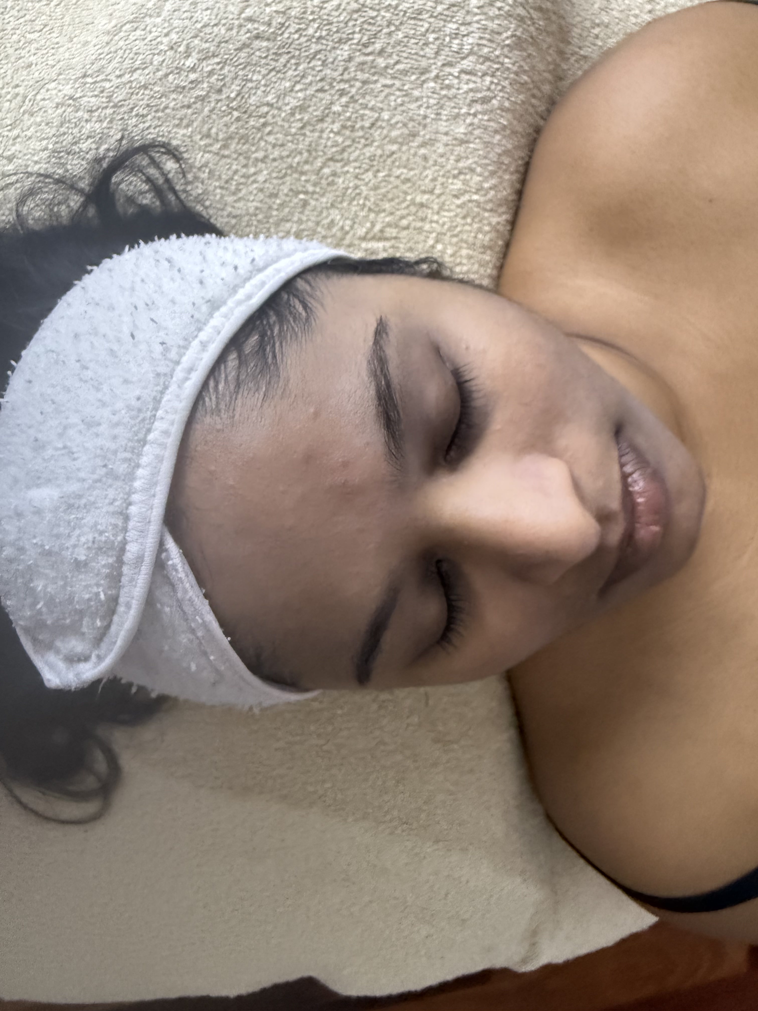 Aqua Glow hydrodermabrasion